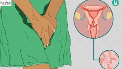 Vaginal Yeast Infection Symptoms, Causes, And Prevention